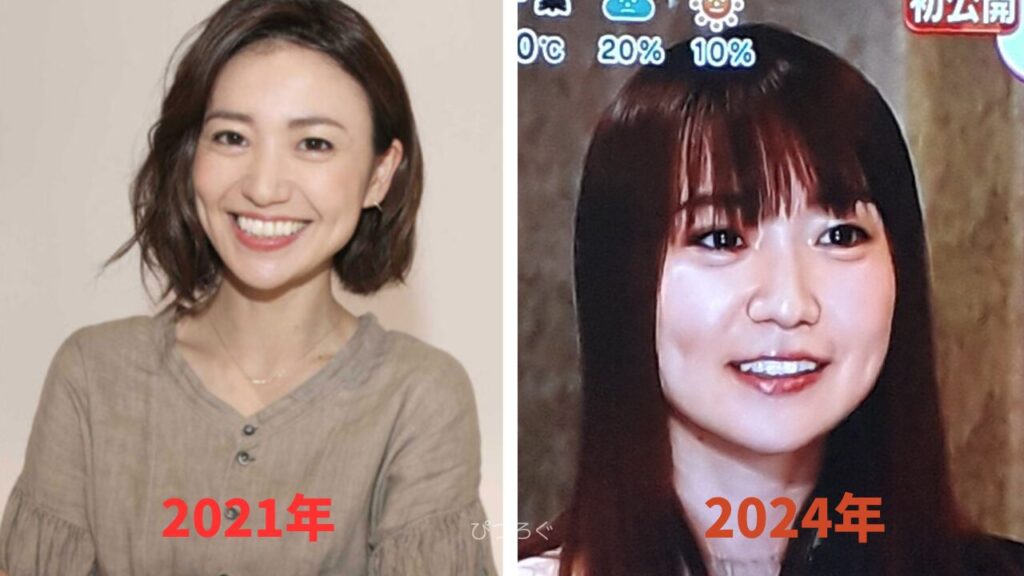 大島優子の顔が変わった？